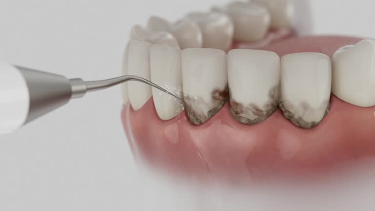 Reliable Dental contractor in Brainerd, MN by Smile Center Dentistry